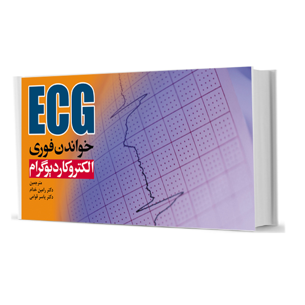 خواندن فوری الکتروکاردیوگرام ECG