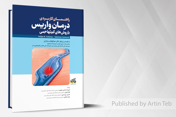 راهنمای کاربری درمان واریس با روش های کم تهاجمی